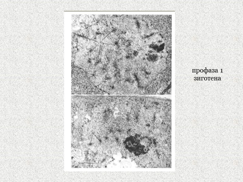 профаза 1 зиготена